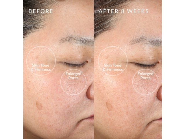 1413-01_BK_A_DETAIL-1